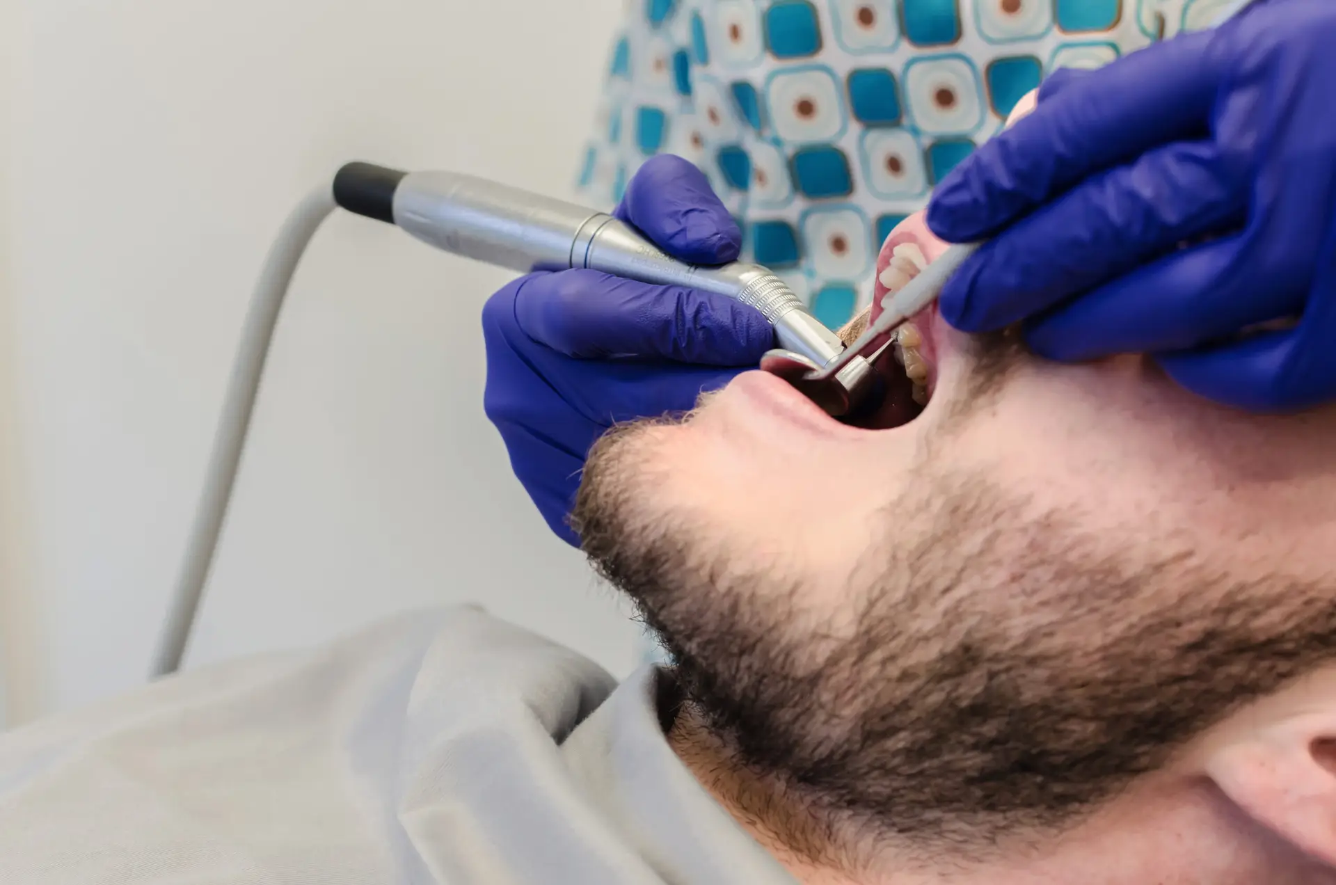 Blogs 3 Tooth extractions